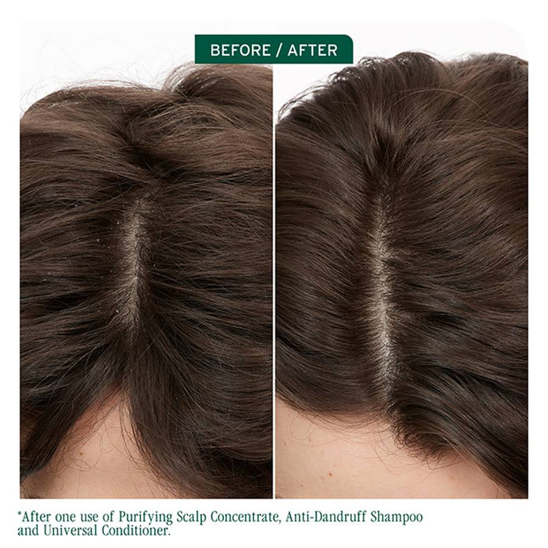 Matrix Biolage Scalp sync Anti-Dandruff Shampoo 400ml