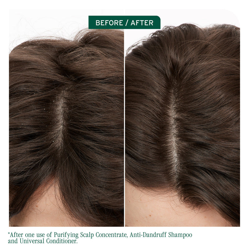 Matrix Biolage Scalp Sync Dandruff Prone Scalp Care Trio Bundle